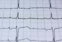 momentum growth analysis tool